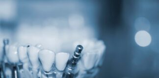 Co to jest gąbka kolagenowa i jak wykorzystuje się ją w implantologii