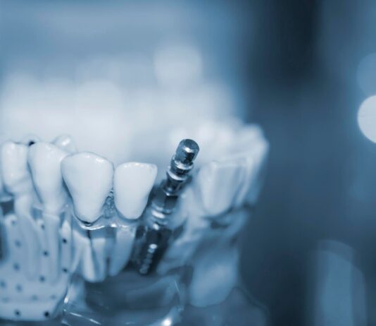 Co to jest gąbka kolagenowa i jak wykorzystuje się ją w implantologii